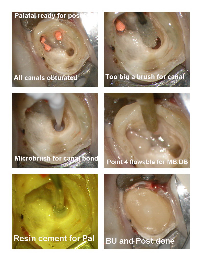 Endo first molar pg 5.jpg